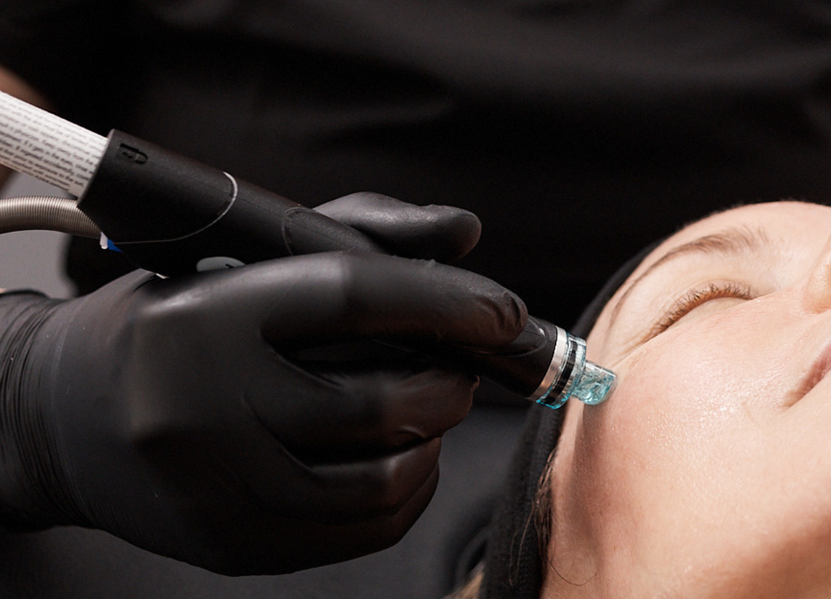 Hydrafacial Treatments vs. Microdermabrasion and Other Non-Invasive Facial Treatments