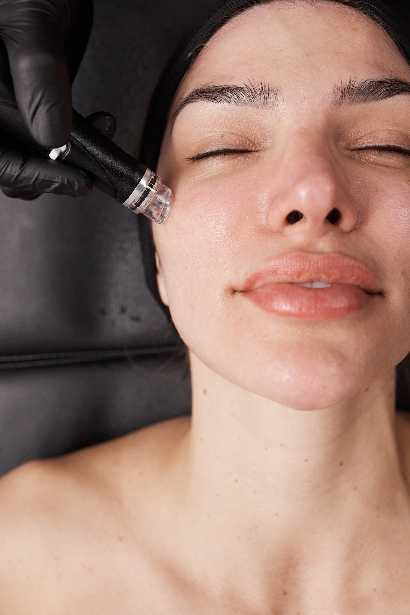 A woman lays back while a black-gloved hand holds a Hydrafacial device with a clear tip against her cheek area.