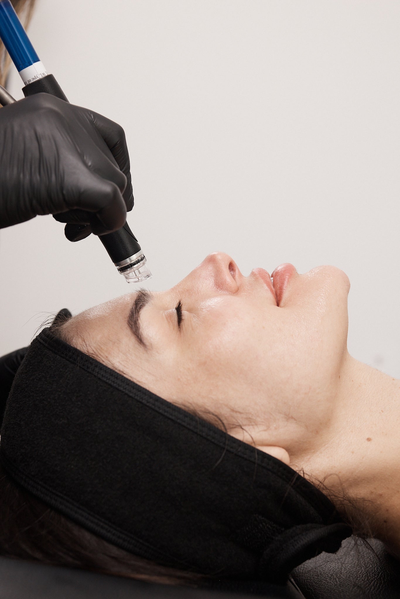 Close-up of a Hydrafacial device applied to a client’s forehead during treatment, with the client relaxed and eyes closed.