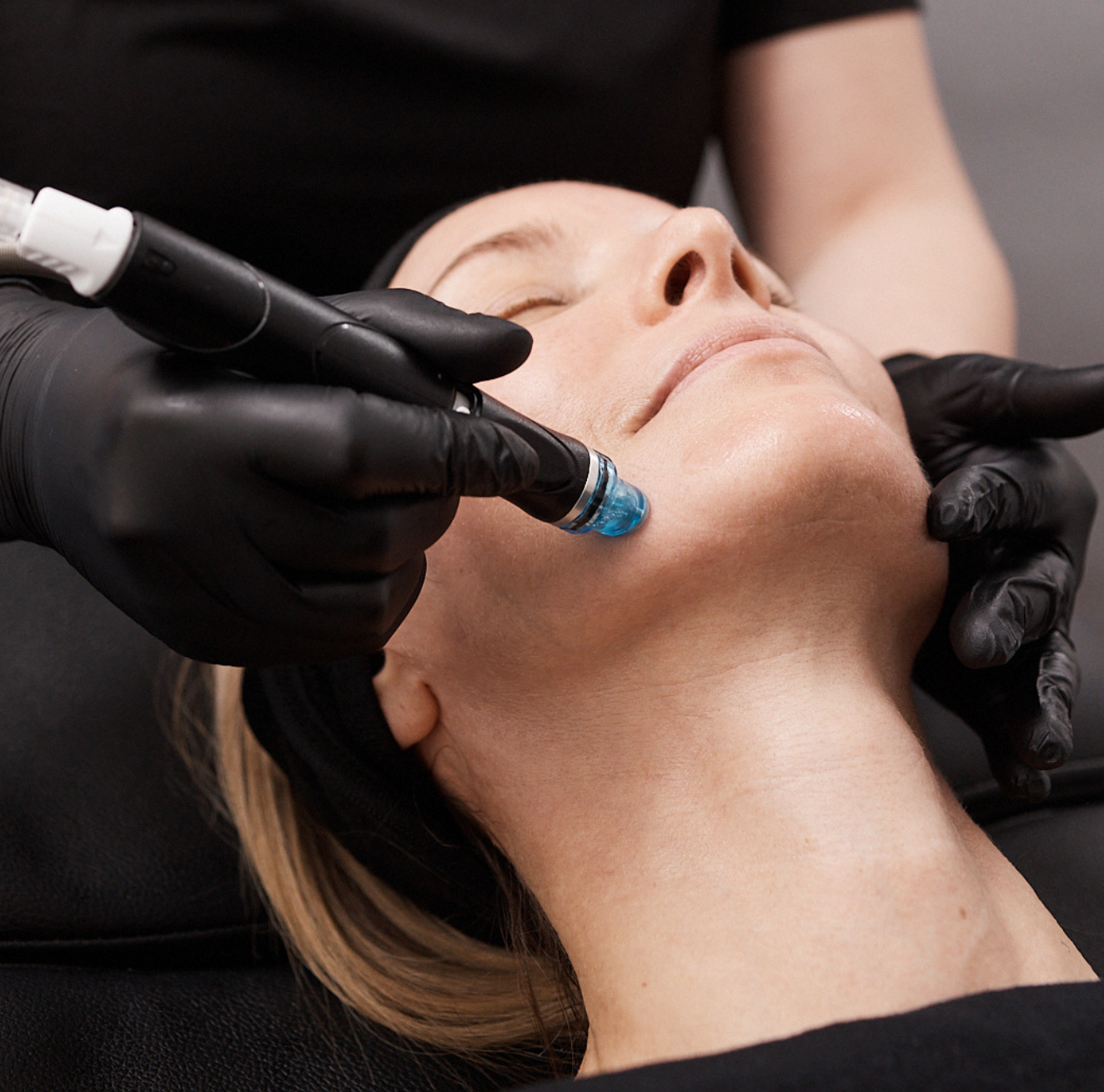 A client lies back with eyes closed as a practitioner uses a Hydrafacial device with a turquoise tip on the chin area. Both of the practitioner’s black-gloved hands are visible supporting the treatment.