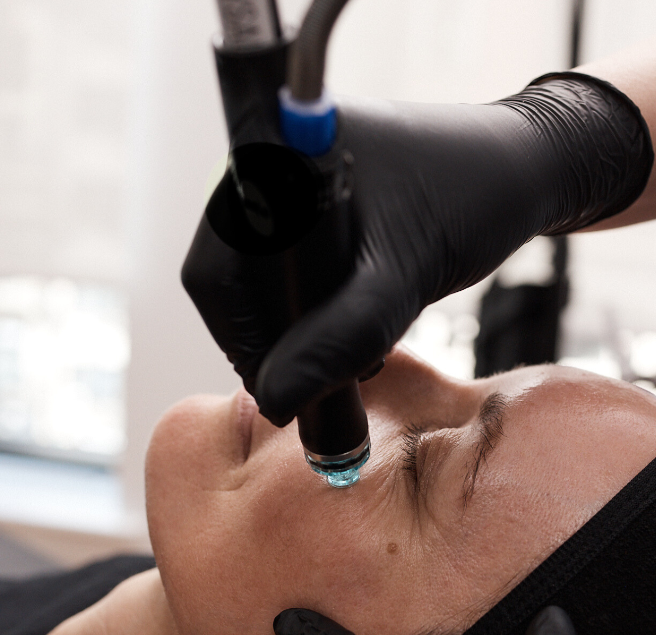 Close-up of a Hydrafacial device with a turquoise tip applied near a client’s eye area. A gloved hand steadies the skin while the device is in use.