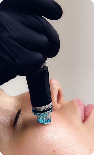 A woman lays back while a black-gloved hand holds a Hydrafacial device with a clear tip against her cheek area.