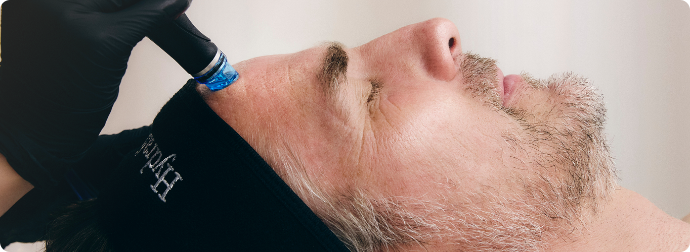 A man reclines with his eyes closed during a Hydrafacial treatment as a provider uses a blue-tipped device on his forehead.