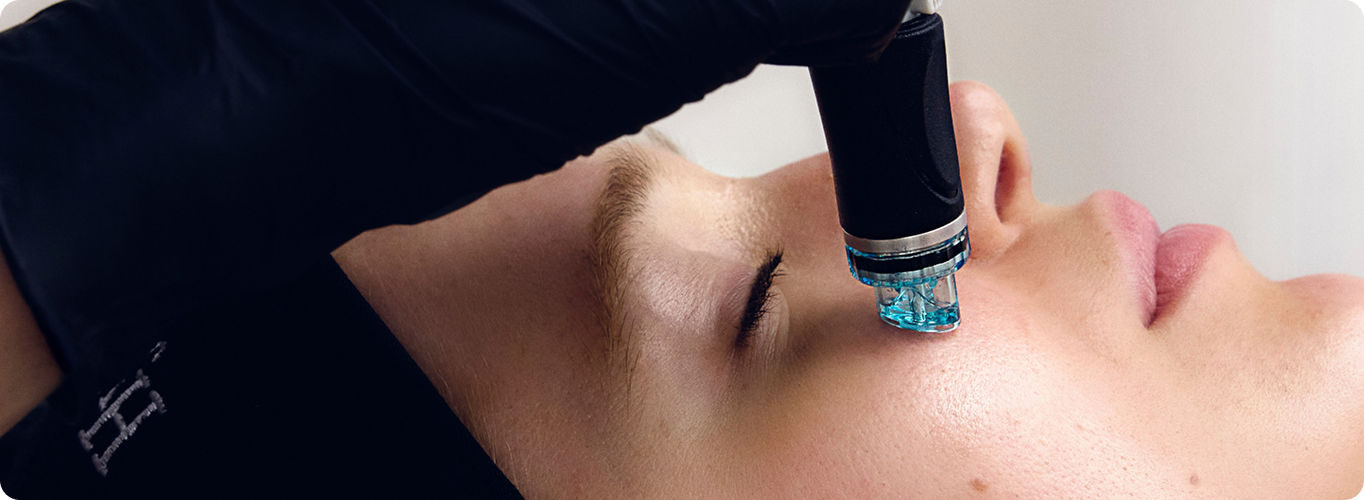 A woman lays back while a black-gloved hand holds a Hydrafacial device with a clear tip against her cheek area.