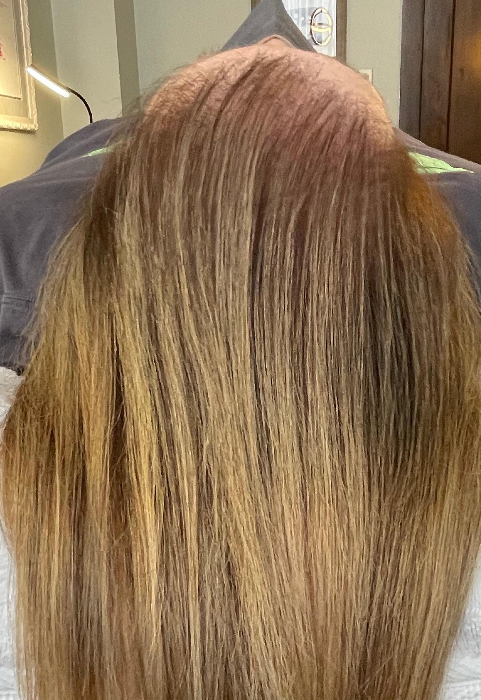 Top-down view of the crown of the head, showing thinning hair with sparse coverage along the scalp and longer hair extending down the sides.