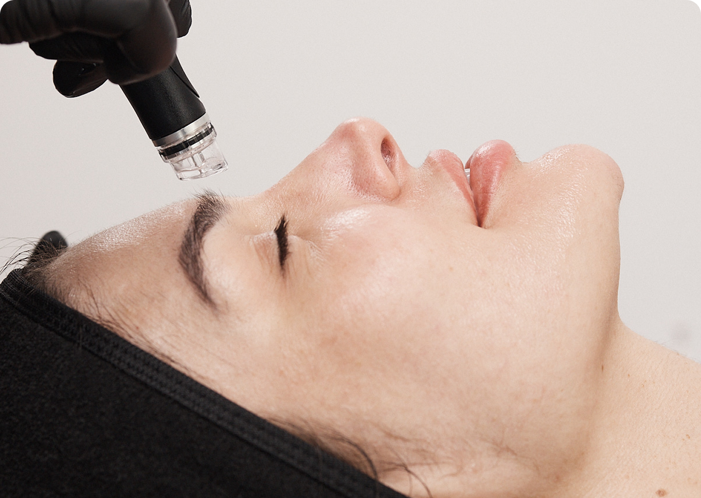 Close-up of a Hydrafacial device applied to a client’s forehead during treatment, with the client relaxed and eyes closed.