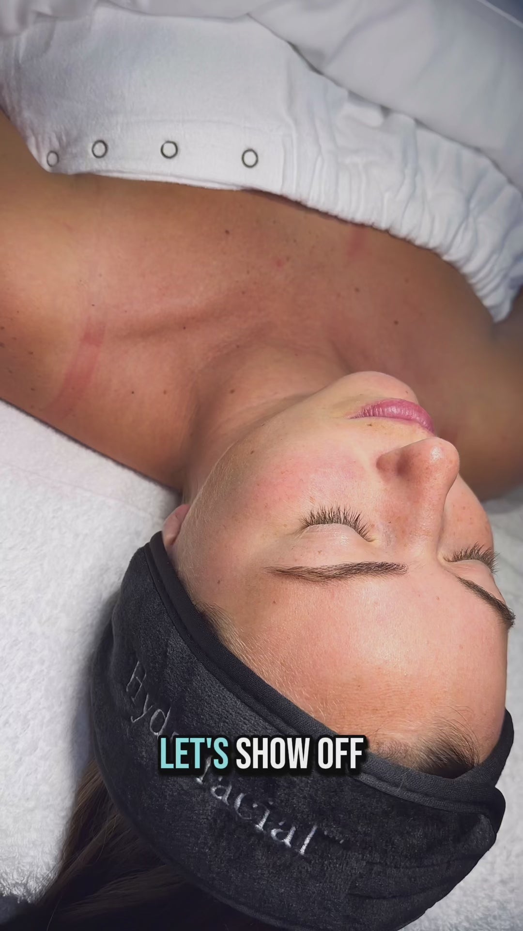 A female client lies back with eyes closed. Her skin appears smooth and glowing, and she wears a black Hydrafacial-branded headband. Overlay text reads: “LET’S SHOW OFF.”